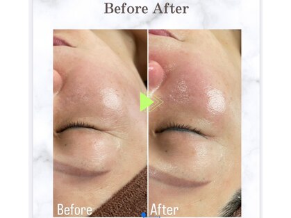 アマリネ(Amarine)の写真