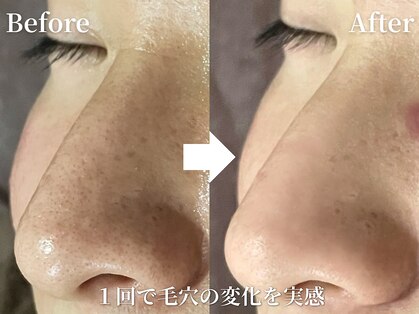 ラヴィアンローズ 泉店 (La vie en Rose)の写真