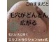 レンリー(Renry)の写真