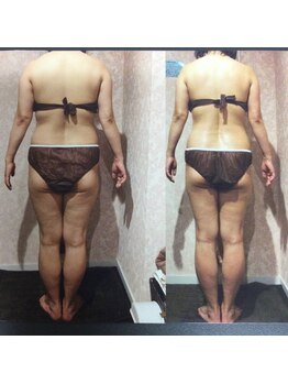 パーフェクトボディプレミアム 神戸三宮店(PERFECT BODY PREMIUM)/お客様 ビフォーアフター(9)