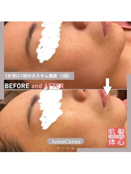 アンナカルナ(AnnaCarna)/細かい悩みも細部までチェック