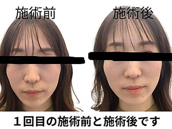 田端整体院/小顔整体/小顔矯正/伊勢崎/