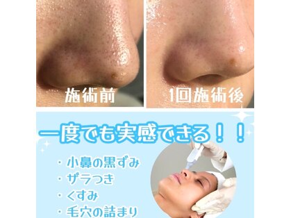 ビーエフジー(B F G)の写真