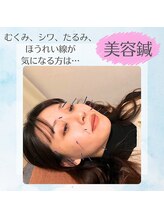 サンライズ鍼灸整骨院 石橋院/美容鍼