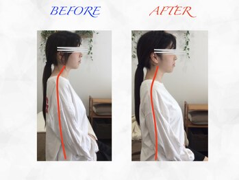 タイナ 岡山(taina)/猫背・巻き肩矯正