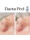 リムビューティー 自由が丘(RymBeauty)の写真/ついに解禁★○ラピール製造者が最上級のピーリングDactorPELLを施術開始！背中のボディピーリングも可能◎