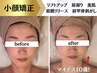 【再来・筋膜小顔リフト上半身コース】口コミ投稿で脂肪燃焼ブースター無料！