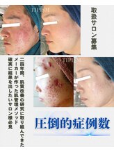 ソリッジ肌管理室/TIPメーカー直営サロン