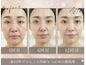 【小顔矯正■人気NO.1】新韓国Vリフト＋７Dコルギ＋頭蓋骨矯正120分￥18999→
