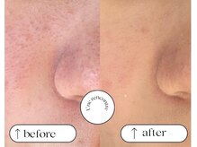 ユヌランコント 岐阜店(Une rencontre)/エンビロン