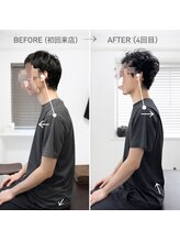 ジェイミープラス 表参道(J‘aimee +)/肩こりビフォーアフター