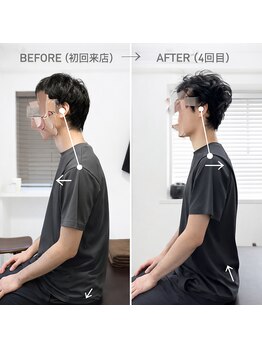 ジェイミープラス 表参道(J‘aimee +)/肩こりビフォーアフター