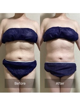 リノレア(Lino_Lea)の写真/速攻効果!!本気で悩んでいる方に！腸セラピストが全身フルコース6,980円