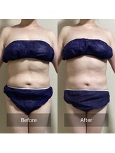 リノレア(Lino_Lea)