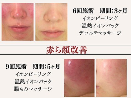 アクール(Accueil)の写真