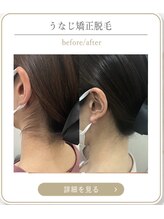 ミース 上野店/うなじ専門店の技術