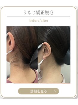 ミース 上野店/うなじ専門店の技術