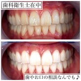 ホワイトベース(White base)