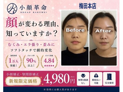 小顔革命 小顔 全身美容矯正専門店の写真