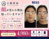 小顔革命 小顔 全身美容矯正専門店