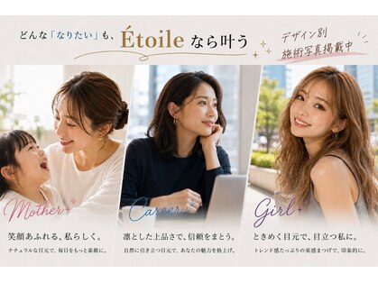 エトワール(Etoile)の写真