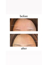 インディバケアプラチナム 心斎橋/