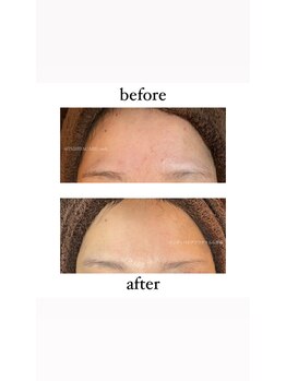 インディバケアプラチナム 心斎橋/