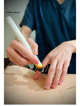 ハリマジック 代官山(HARI MAGIC)/【代官山/鍼灸/美容鍼】