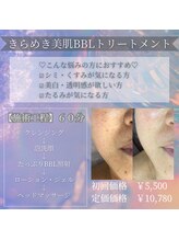 アミオ(amio)/ダウンタイムはありません！
