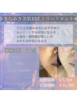 アミオ(amio)/ダウンタイムはありません！