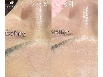 トリンテ バイ フェース(TRINTE by FAITH)の写真