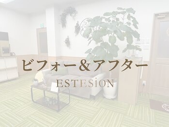 エステシオン(ESTESiON)/ビフォー&アフター