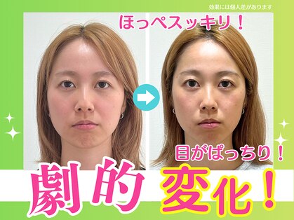 上越かがやき整体院の写真