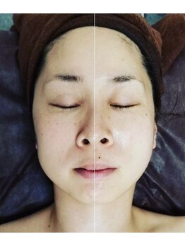 サロン シェリミー(Cheri mi)/光フェイシャル