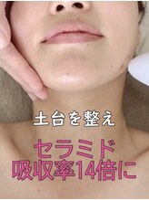 マヴィ くずは店(MavY.)/ノンニードル水光注入の秘密