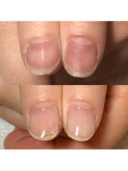 カンパニュラ(Campanula)/自爪育成コース