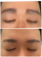 ミニョン(mignon)/メンズハリウッドブロウリフト