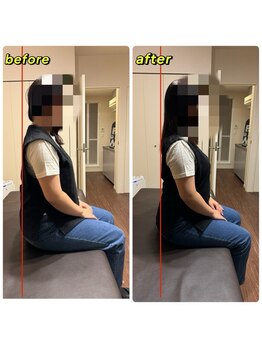 アンティオール 桜木町店/Before→After