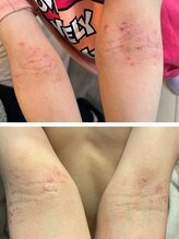 フィール(feel)/Before/After