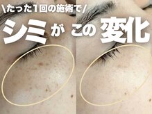 モモイロ(momoiro)