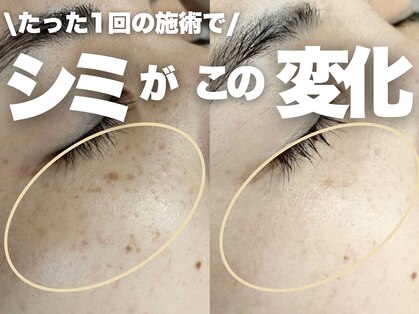 モモイロ(momoiro)の写真