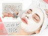 【6月末まで！】赤ニキビ・皮脂コントロール／コモデックス¥ 11,000→