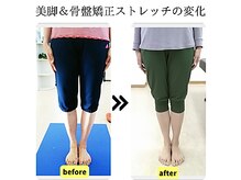 ストレッチヒーロー 岡山問屋町店/O脚改善できれいな脚に！