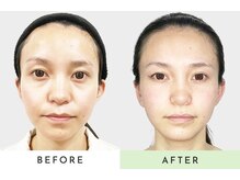 プラスフィール 梅田店/美容整体/エステ/リラク/コルギ