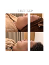 リルシープ(LIL'SHEEP)/陶肌トリートメント１回