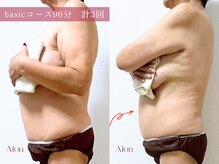 アイオン(Aion)/basicコース90分　計4回での変化