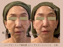 シア(Shia)の雰囲気（肌を育てるフェイシャル＊たるみ/シミシワ/目指せノーファンデ肌）