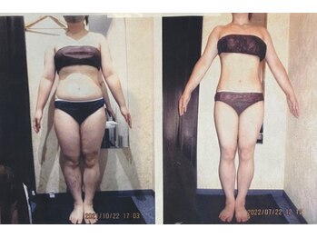 パーフェクトボディプレミアム 大阪難波店(PERFECT BODY PREMIUM)/お客様 ビフォーアフター(28)