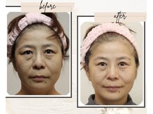 ビューティーセラピーマジック 自由が丘店(Beauty Therapy Magic)/お客様ビフォーアフター