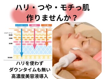 ハピエルルーム(HAPPYEL ROOM)/ダウンタイム無しの美容成分導入